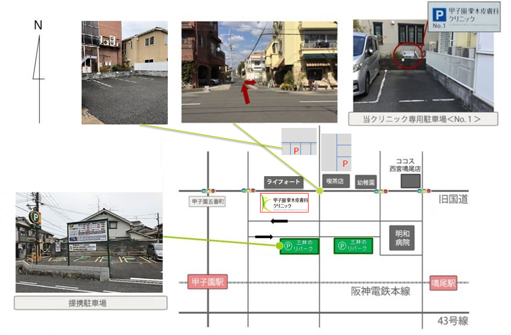 駐車場MAP