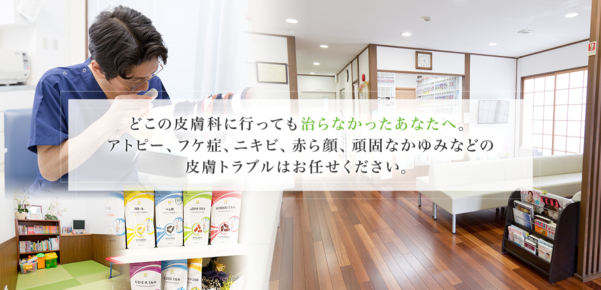 どこの皮膚科に行っても治らなかったあなたへ。アトピー、フケ症、ニキビ、赤ら顔、頑固なかゆみなどの皮膚トラブルはお任せください。｜西宮市の皮膚科の甲子園栗木皮膚科クリニック