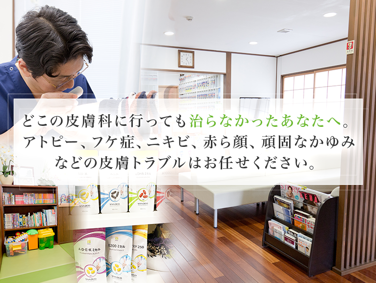 どこの皮膚科に行っても治らなかったあなたへ。アトピー、フケ症、ニキビ、赤ら顔、頑固なかゆみなどの皮膚トラブルはお任せください。｜西宮市の皮膚科の甲子園栗木皮膚科クリニック
